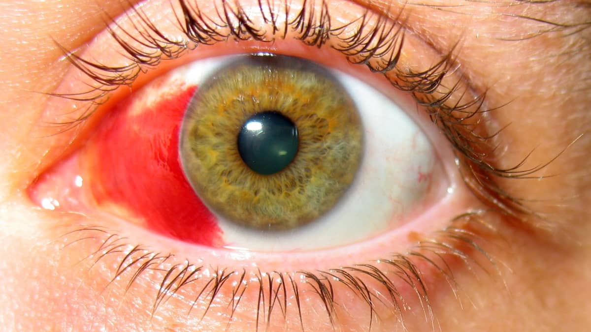 eye clinic abuja