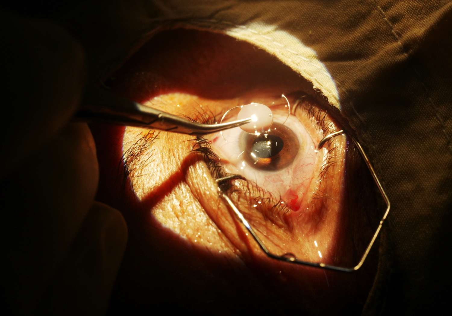 eye clinic abuja 42