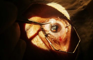eye clinic abuja 42